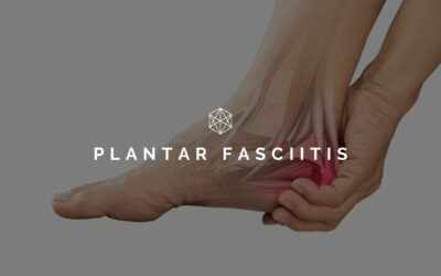 Will Physiotherapy Help Plantar Fasciitis?